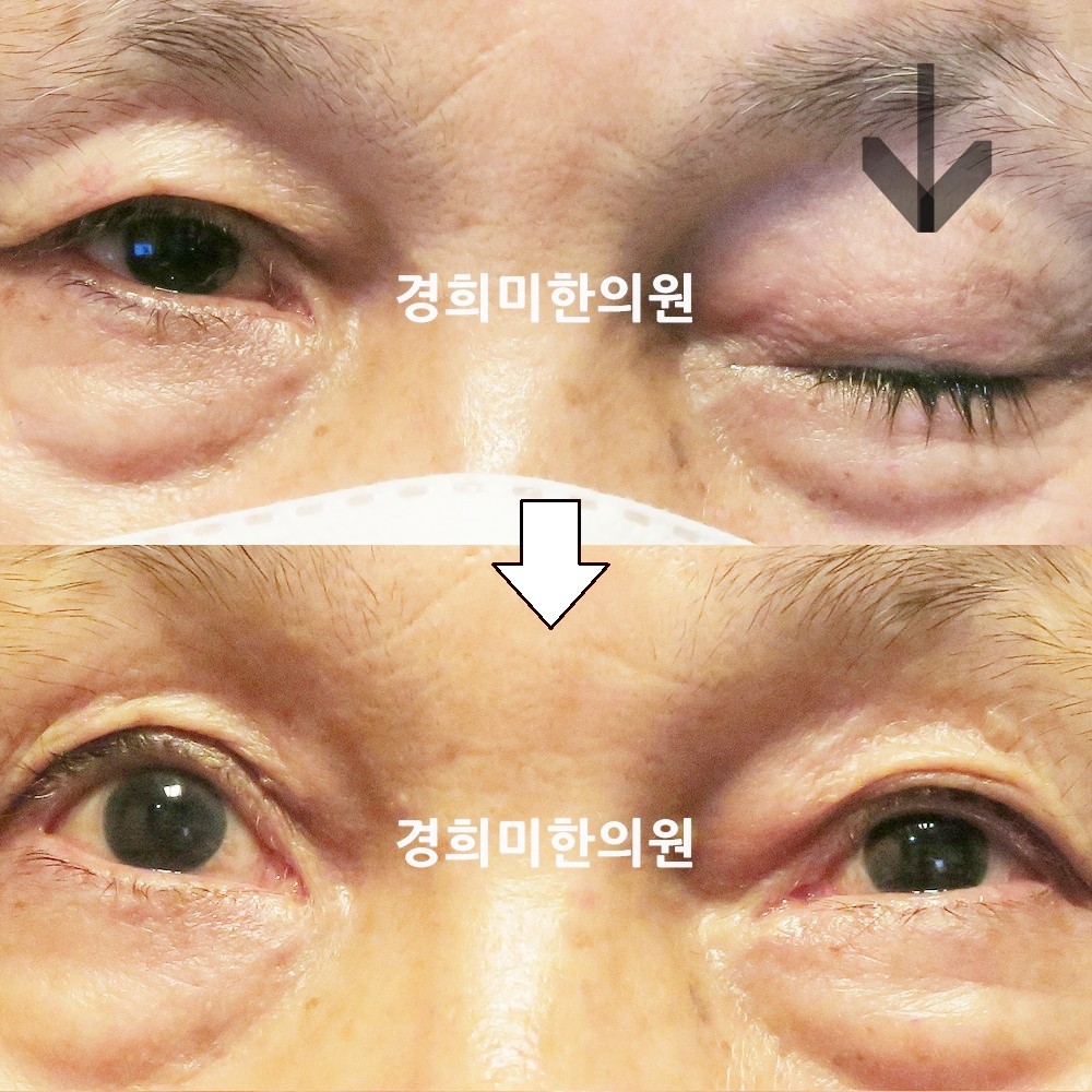 127번-22104-2-강강강-표시.jpg