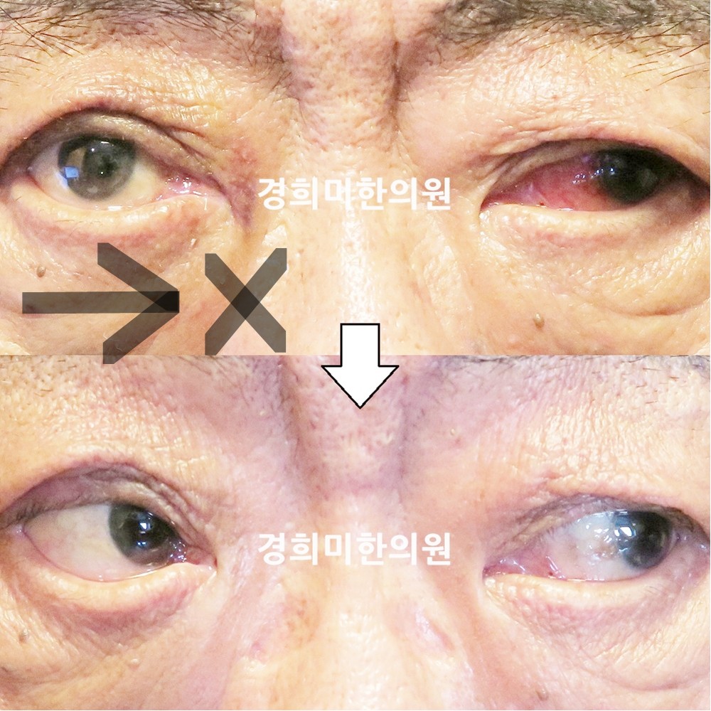 129번-22386-강강강-표시.jpg