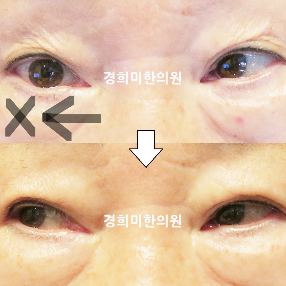 130번-22563-강강중-표시.jpg