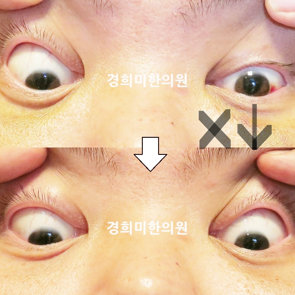 6번-22422-강강중-표시.jpg