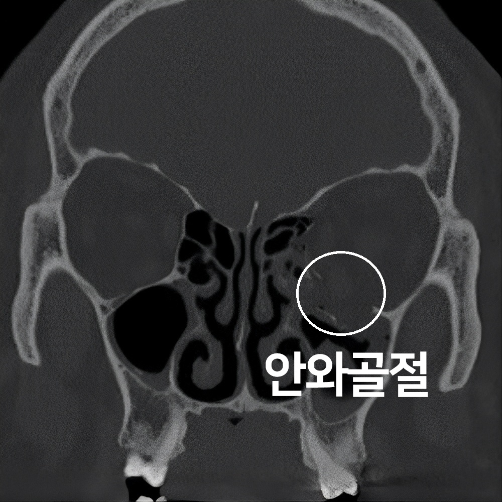 6번-조운채-ct3.jpg