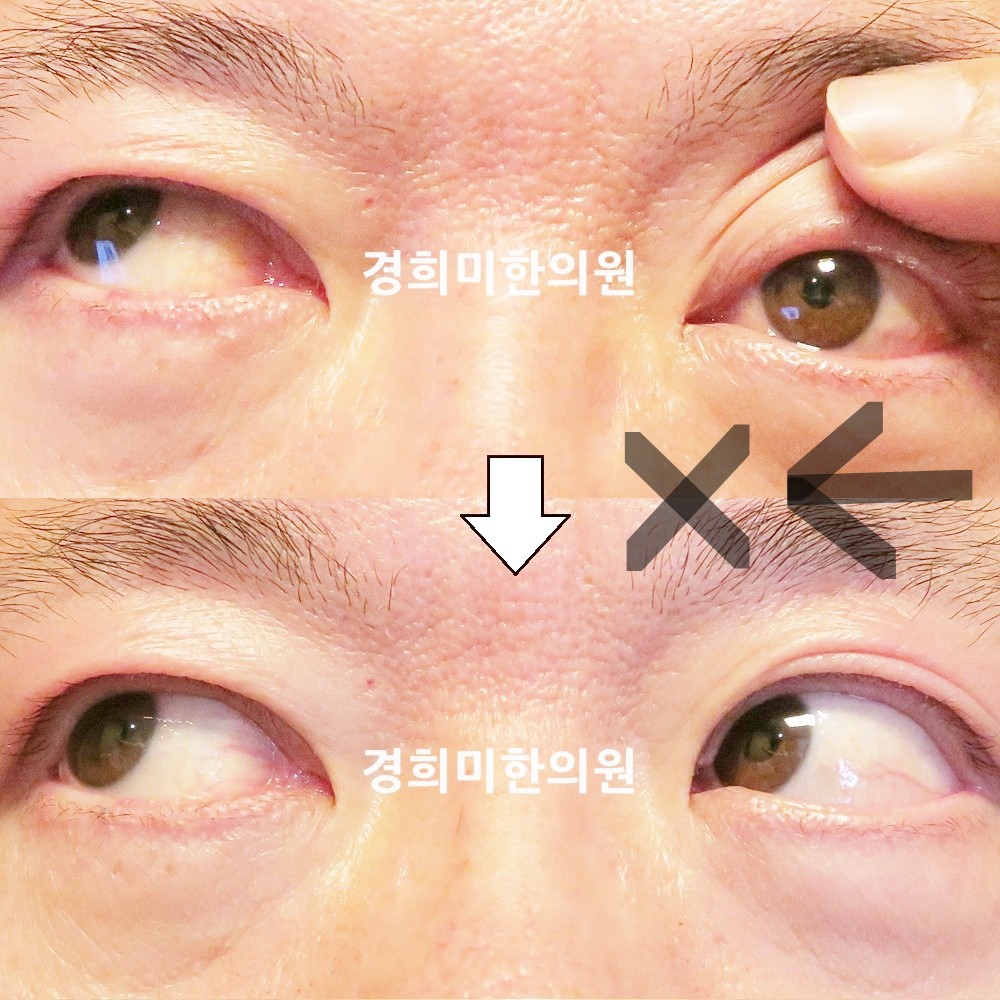31번-22733-1-강강강-표시.jpg