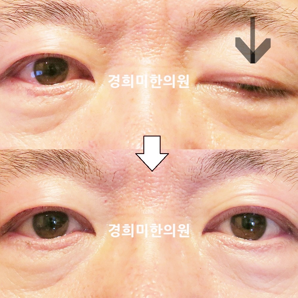 31번-22733-2-강강강-표시.jpg
