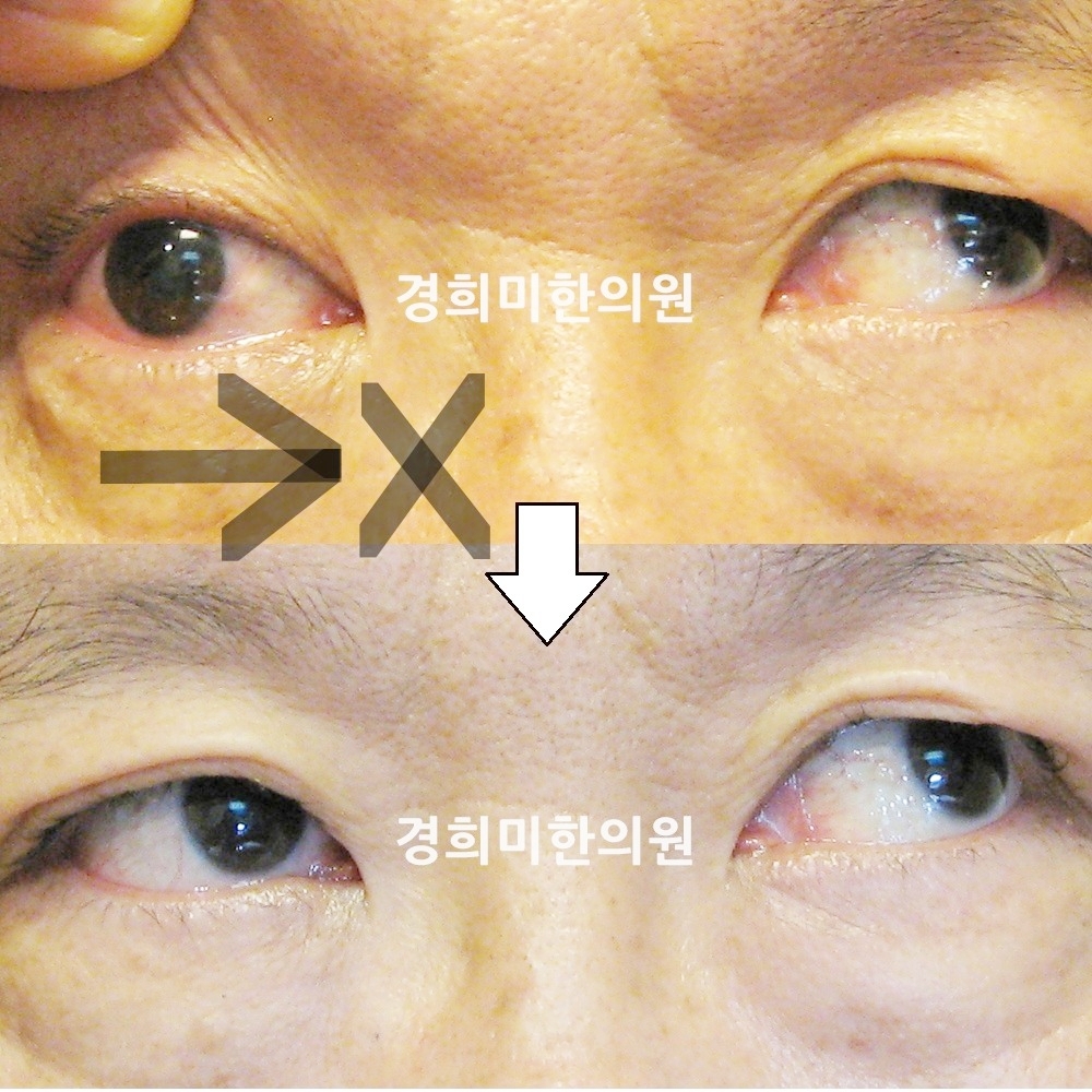 131번-13524-2-강강중-표시.jpg