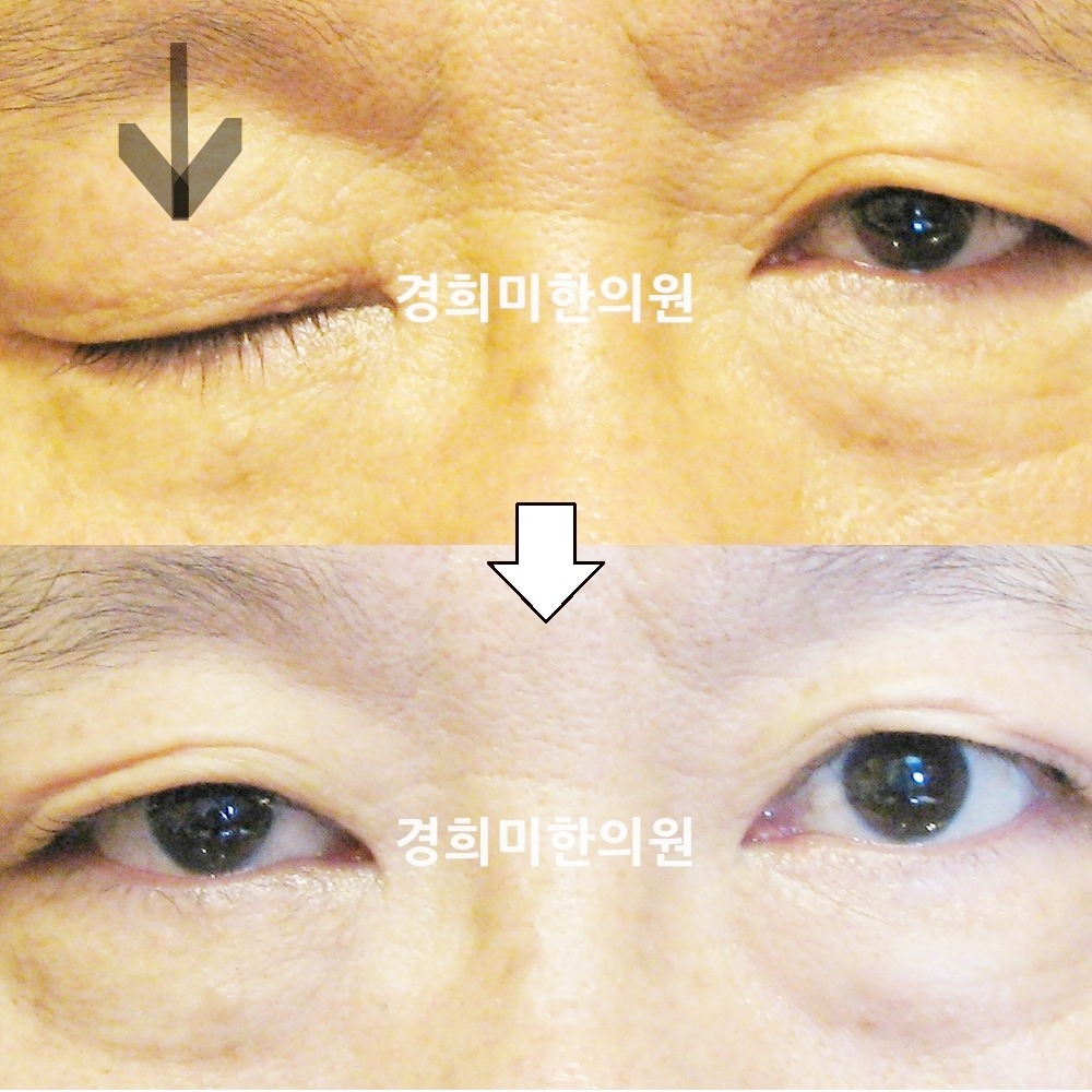 131번-13524-1-강강중-표시.jpg