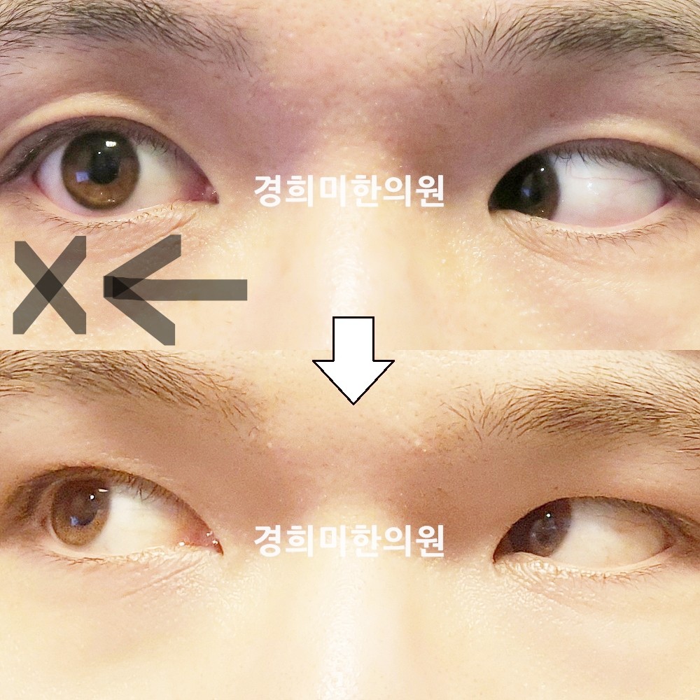 132번-23628-강강중-표시.jpg