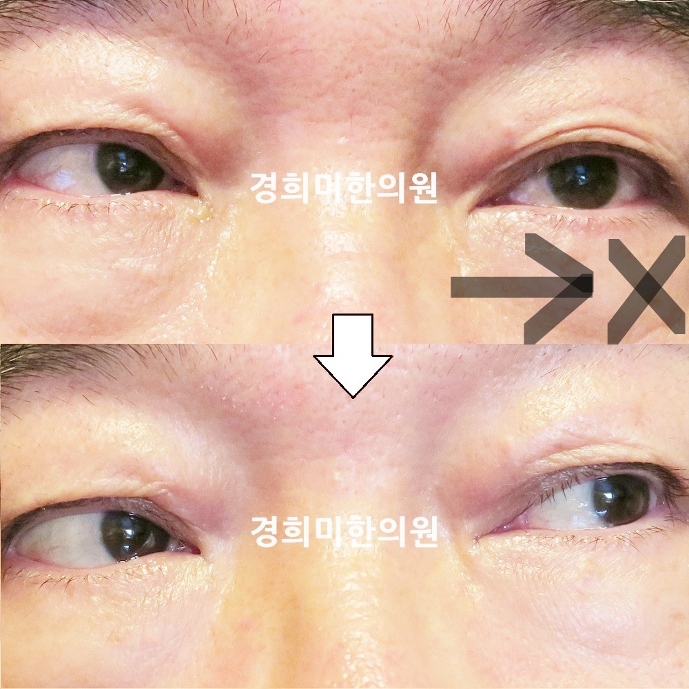 133번-23184-강강강-표시.jpg