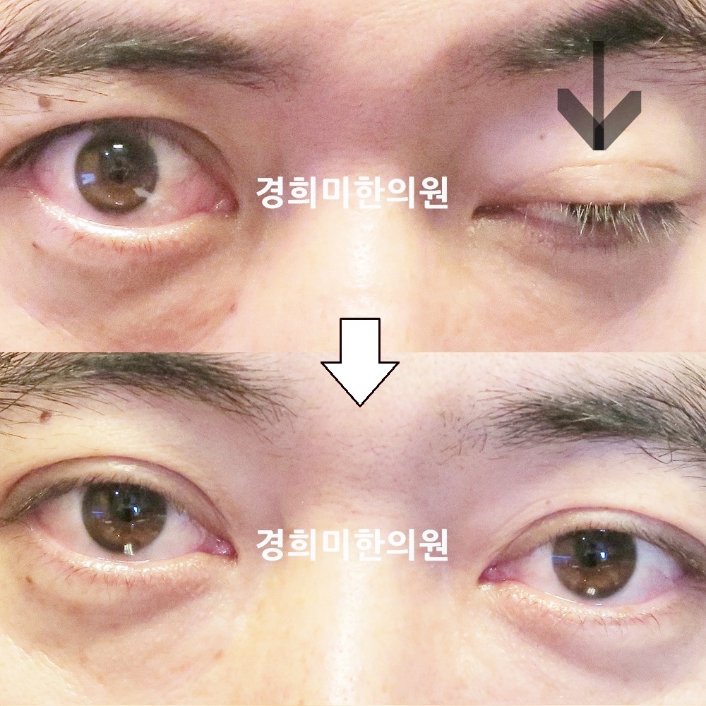 134번-22340-1-강강강-표시.jpg