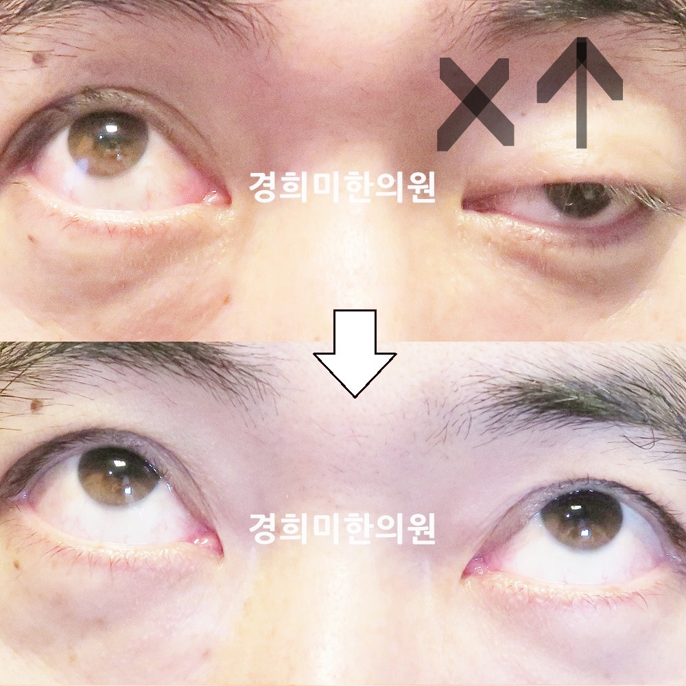 134번-22340-2-강강강-표시.jpg