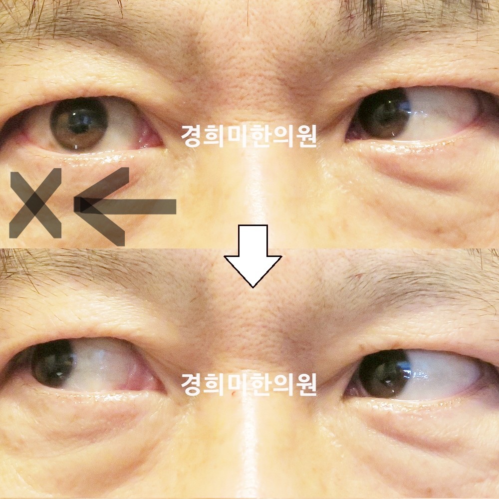 135번-22970-강강중-표시.jpg