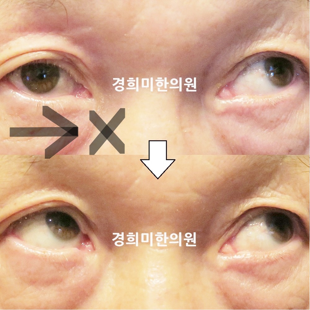 136번-23352-1-강강강-표시.jpg