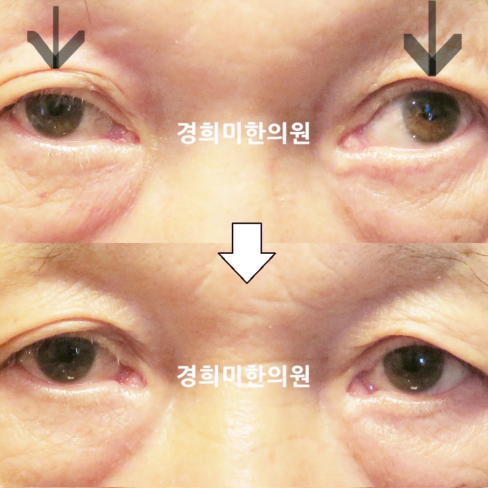 136번-23352-2-강강강-표시.jpg