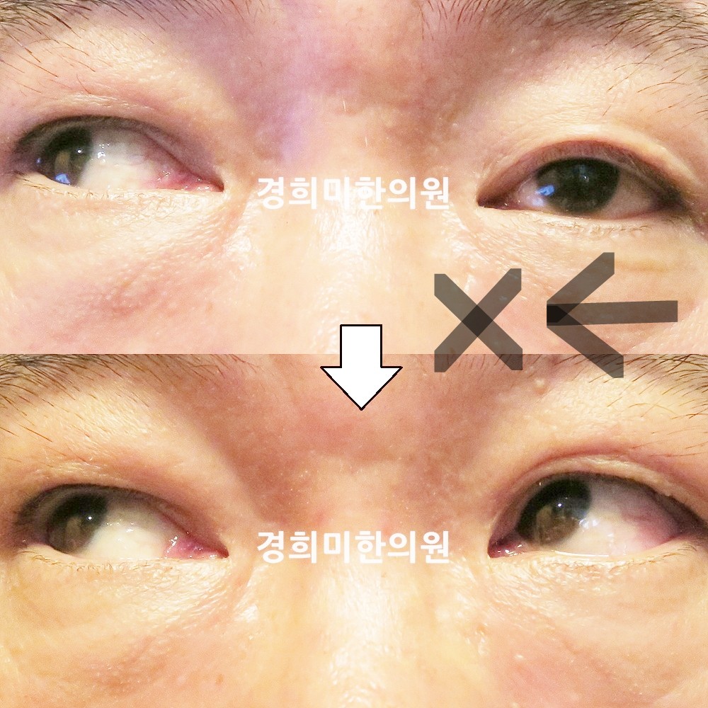 63번-23355-1-강강강-표시.jpg