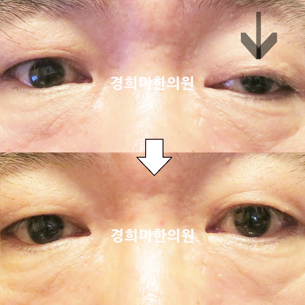 63번-23355-2-강강강-표시.jpg