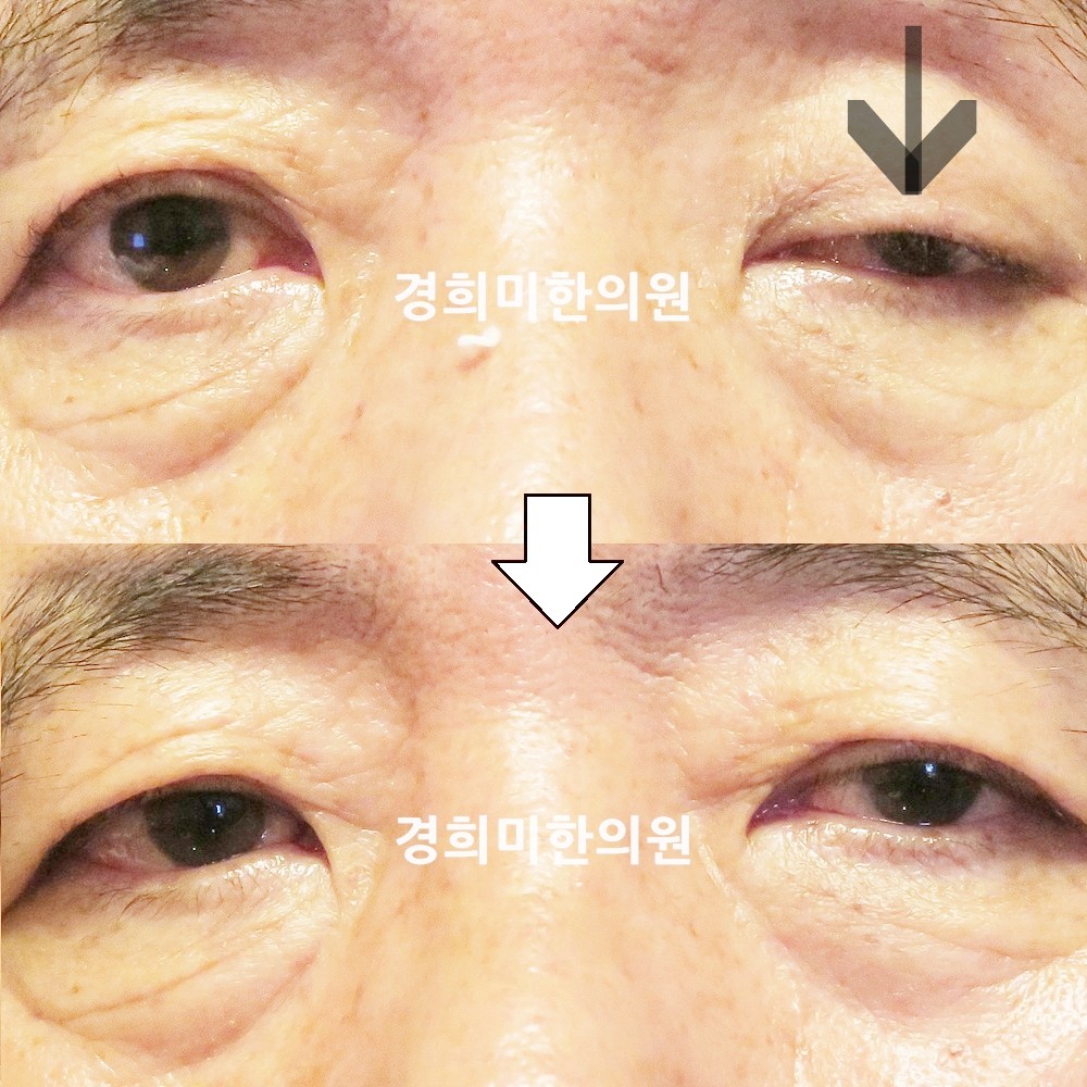 139번-23452-2-강강강-표시.jpg