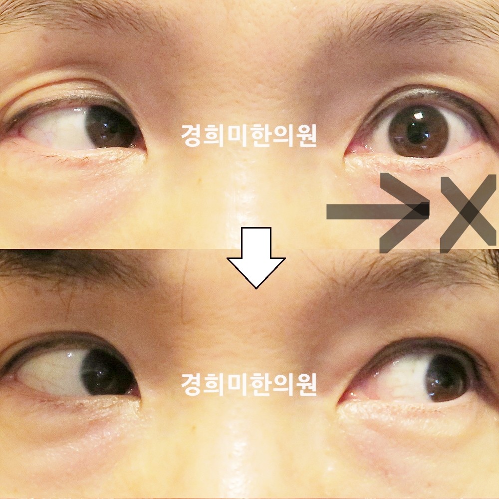 140번-22649-강강중-표시.jpg