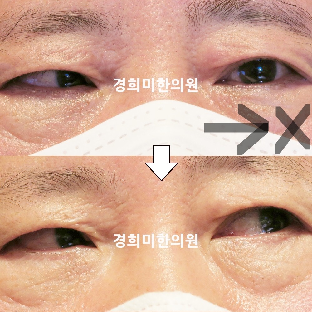 103번-21534-강강강-표시.jpg