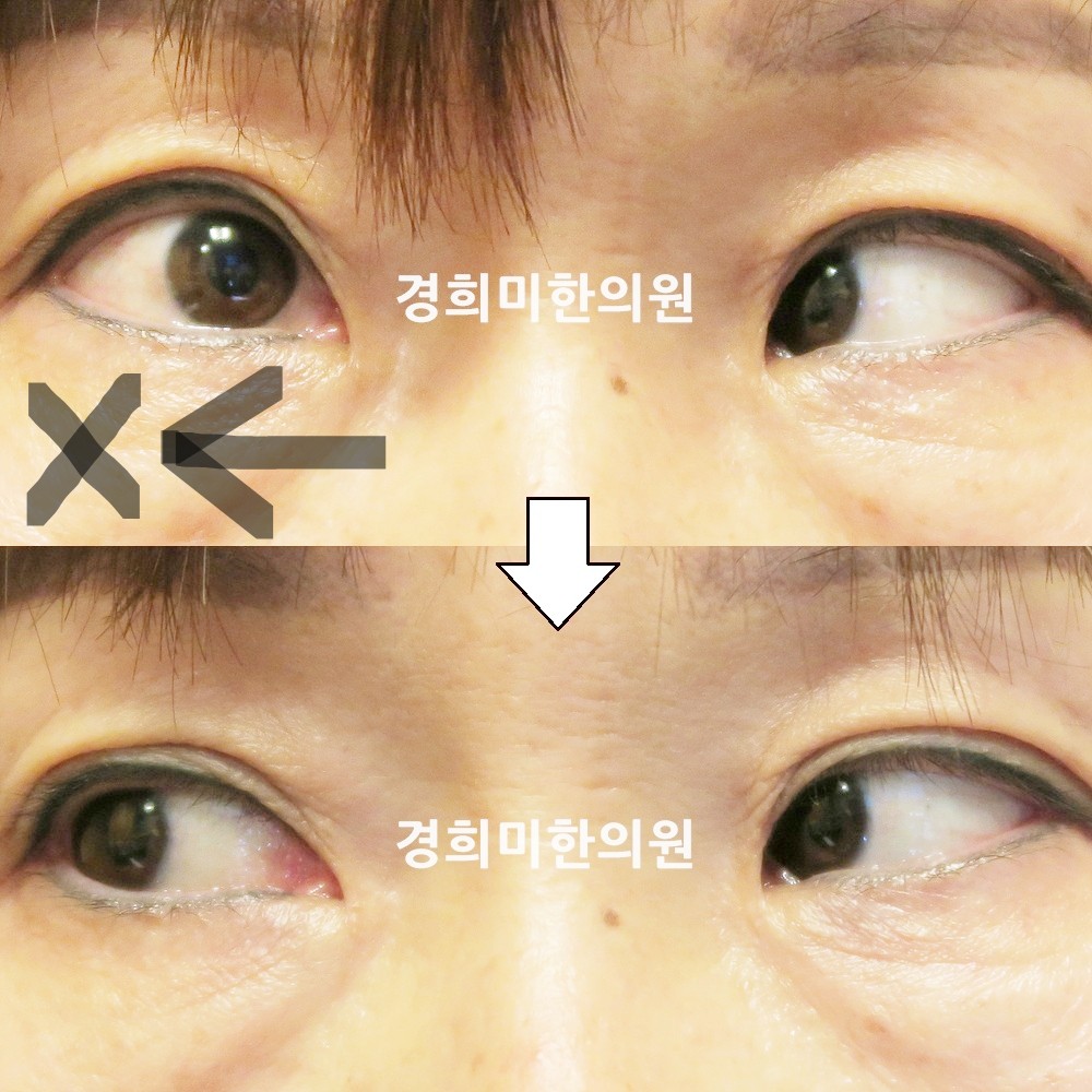 126번-17930-강강중-표시.jpg