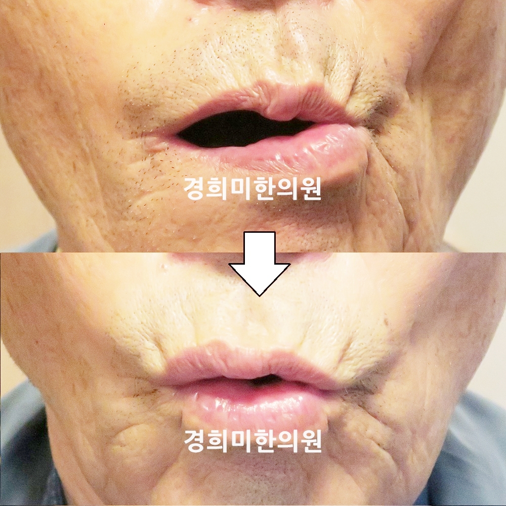 17번-23341-강강중.jpg