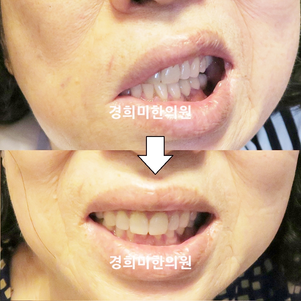 19번-22148-1-강강중.jpg
