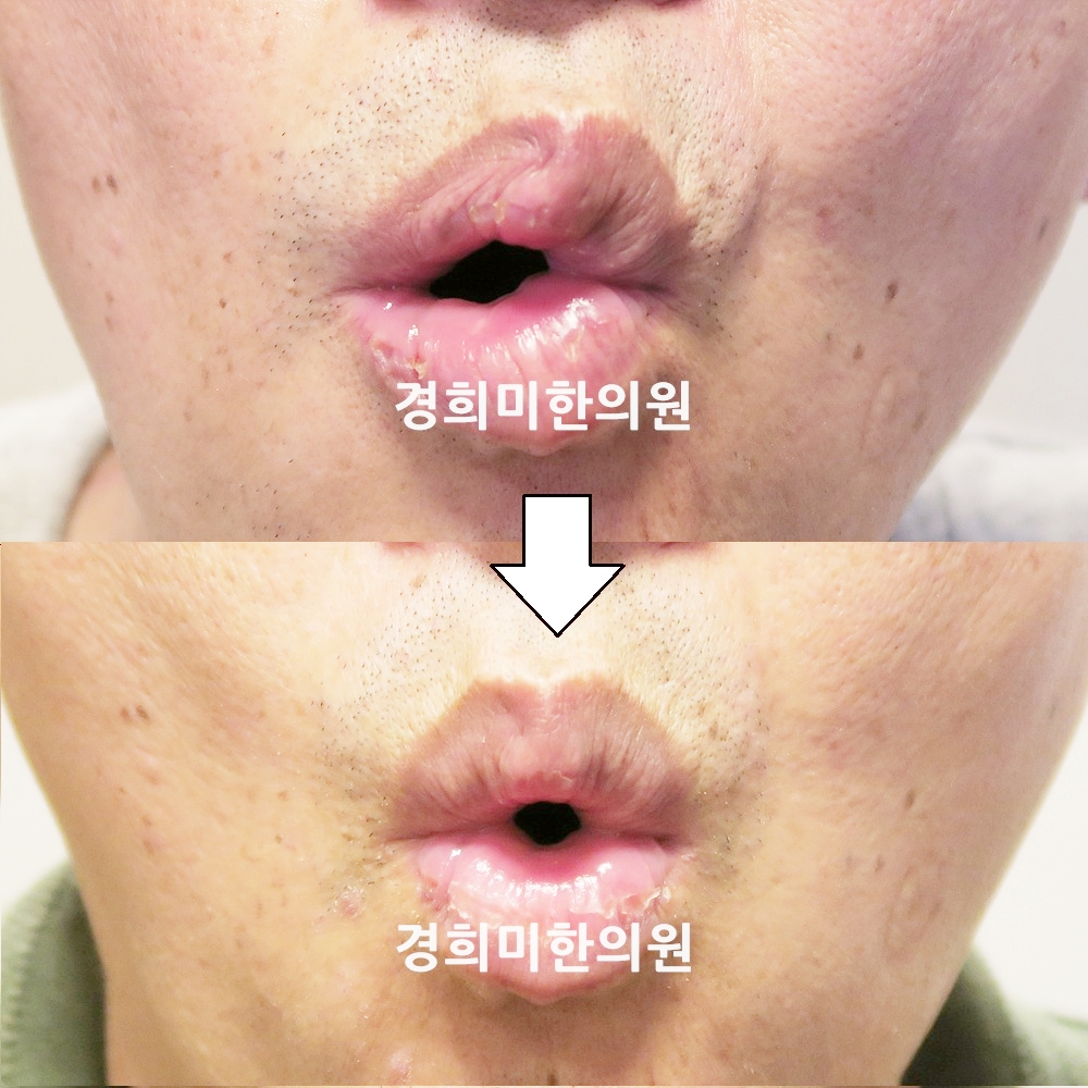 20번24662-2-강강중.jpg