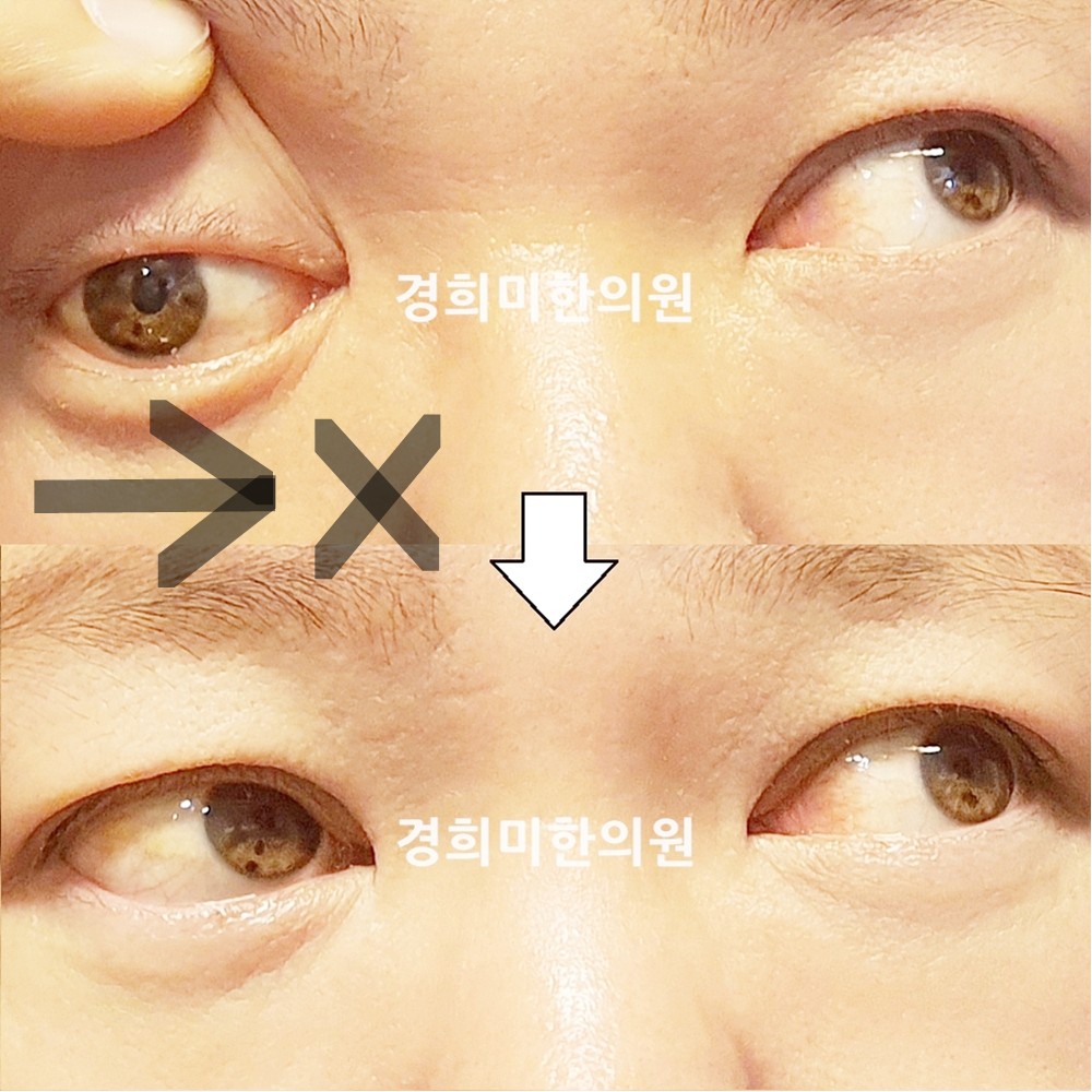 141번-23972-1-강강약-표시.jpg