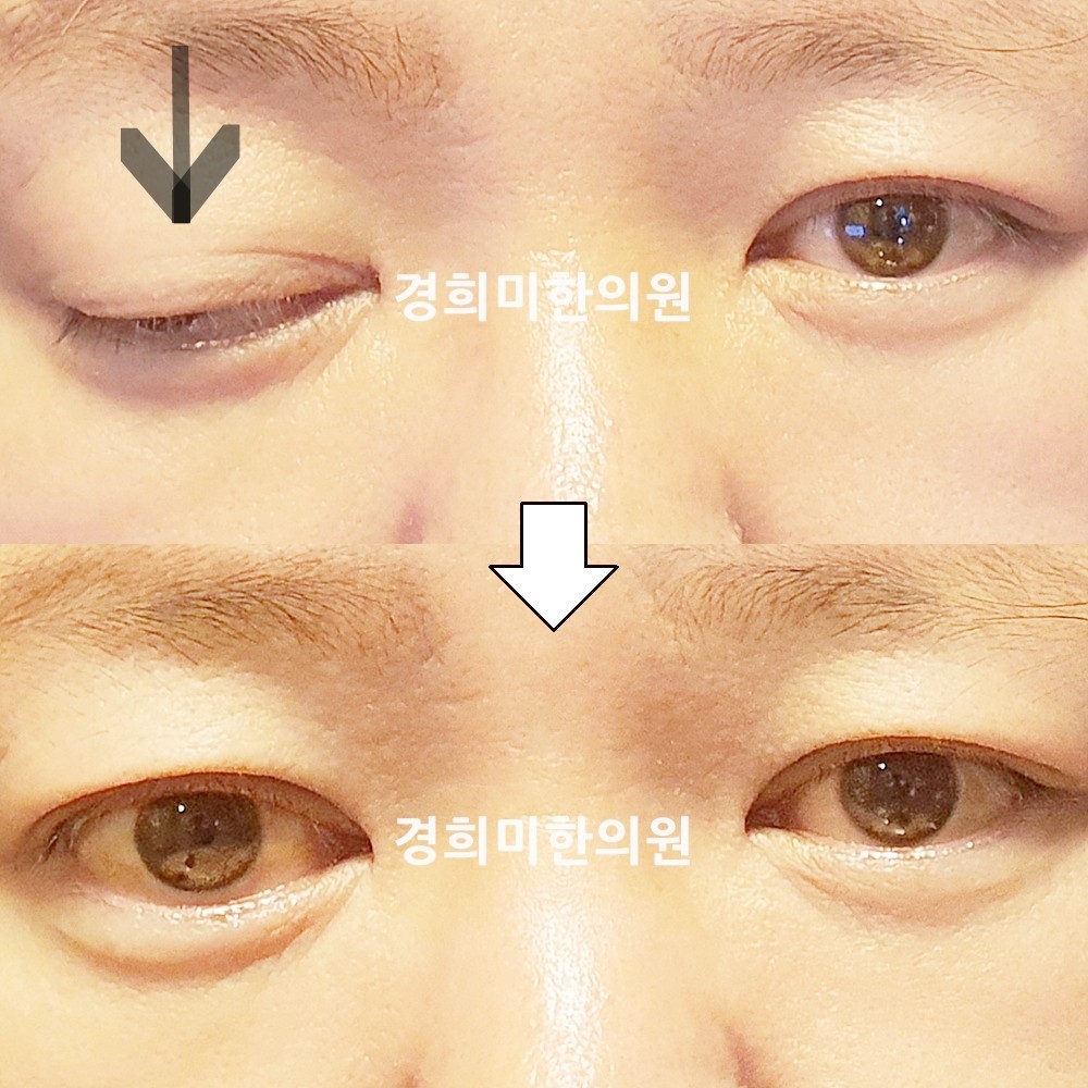 141번-23972-2-강강약-표시.jpg