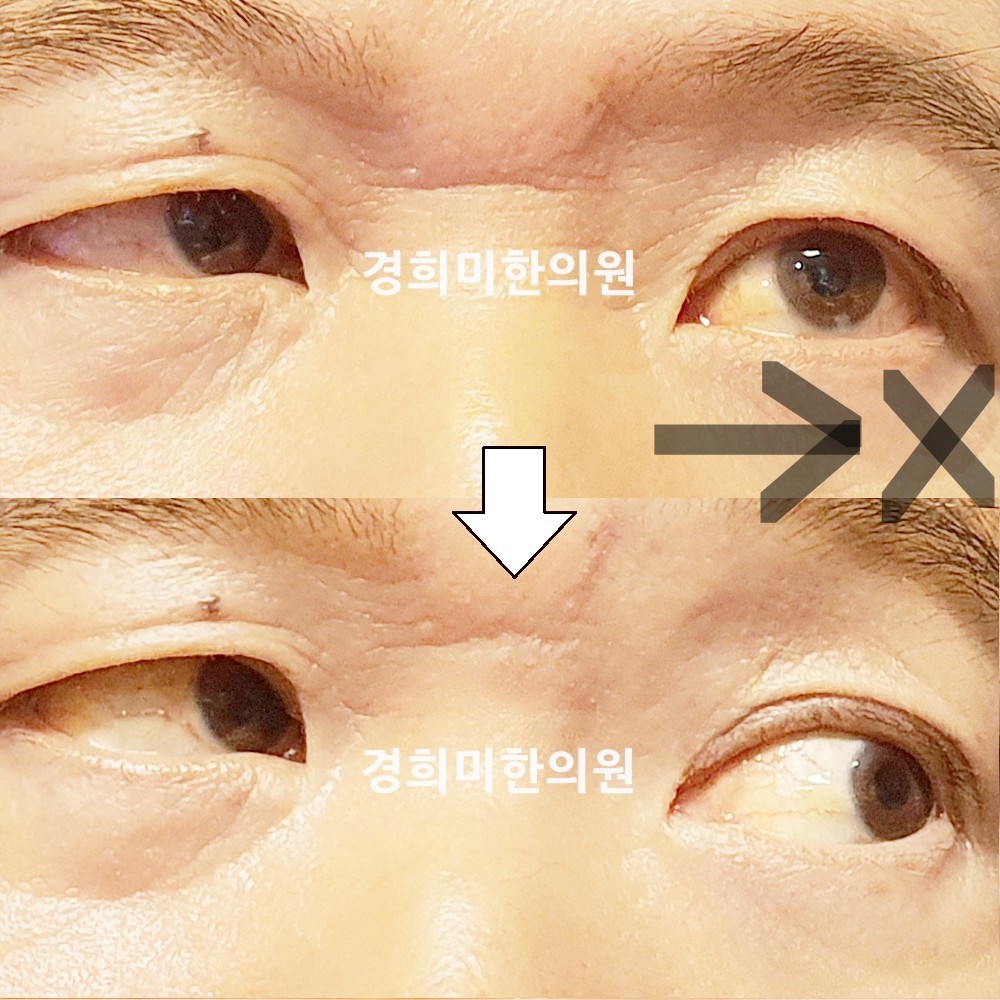 142번-23993-강강약-표시.jpg