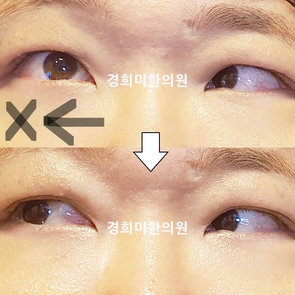143번-24021-강강약-표시.jpg