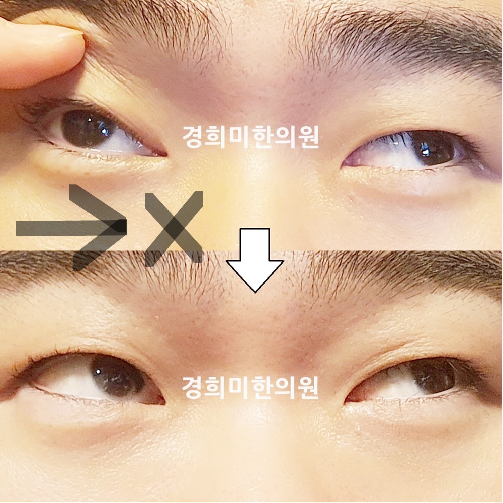 145번-24237-1-강강약-표시.jpg