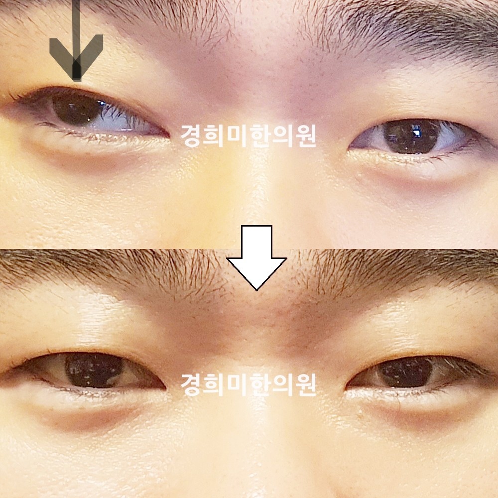 145번-24237-2-강강약-표시.jpg