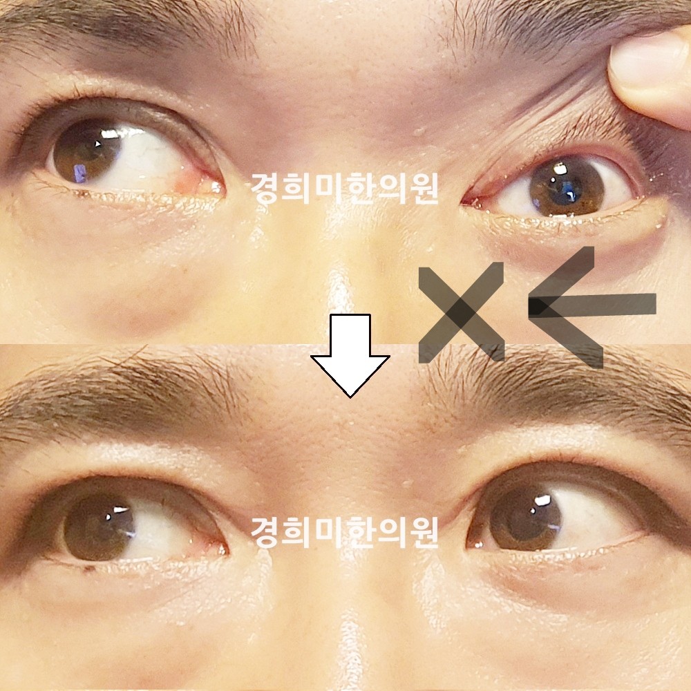 144번-24103-1-강강-표시.jpg