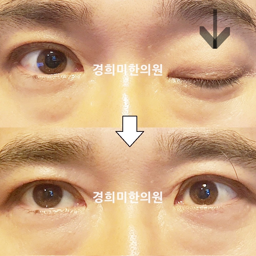 144번-24103-2-강강-표시.jpg