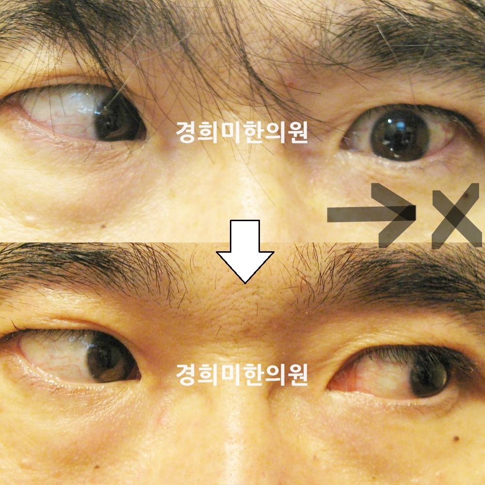 146번-10399-강강-표시.jpg