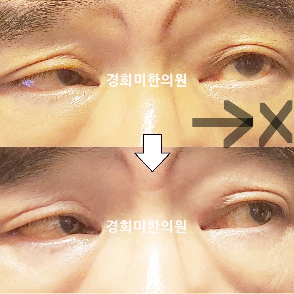 3번-24292-강강-표시.jpg