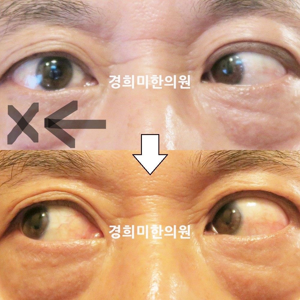 133번-13869-강강중-표시.jpg
